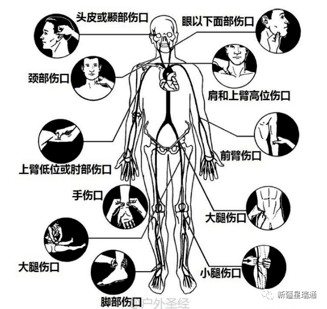 急救医疗小知识医疗治疗(图3)