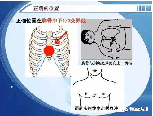 急救医疗小知识医疗治疗(图6)