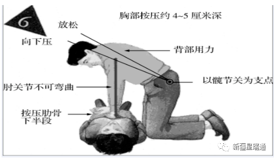 急救医疗小知识医疗治疗(图7)